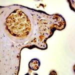 hCG b-subunit Antibody in Immunohistochemistry (Paraffin) (IHC (P))