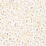 HIV, p18 Antibody in Immunocytochemistry (ICC/IF)