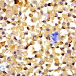 HIVgp160, gp120, gp41 Antibody in Immunohistochemistry (Paraffin) (IHC (P))