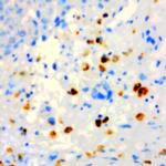 Morphine Antibody in Immunohistochemistry (Paraffin) (IHC (P))