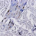 Tat epitope 1 Antibody in Immunohistochemistry (Paraffin) (IHC (P))