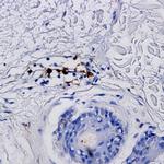 TGF alpha Antibody in Immunohistochemistry (Paraffin) (IHC (P))
