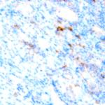 CD61 Antibody in Immunohistochemistry (Paraffin) (IHC (P))