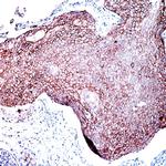 Desmoglein 3 Antibody in Immunohistochemistry (Paraffin) (IHC (P))