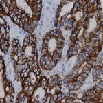 Phosphotyrosine Antibody in Immunohistochemistry (Paraffin) (IHC (P))