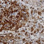 Melanosome Antibody in Immunohistochemistry (Paraffin) (IHC (P))