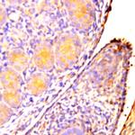 PAX8 Antibody in Immunohistochemistry (Paraffin) (IHC (P))