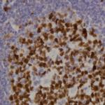 BRCA1 Antibody in Immunohistochemistry (Paraffin) (IHC (P))