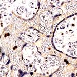 Uroplakin-3 Antibody in Immunohistochemistry (Paraffin) (IHC (P))