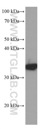SGTA Antibody in Western Blot (WB)
