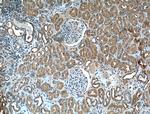 FOLR1 Antibody in Immunohistochemistry (Paraffin) (IHC (P))