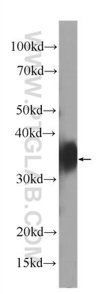 FOLR1 Antibody in Western Blot (WB)