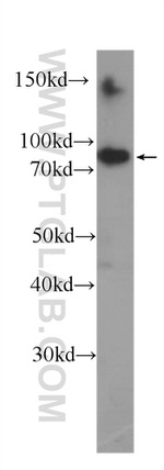 HSP90 Antibody in Western Blot (WB)
