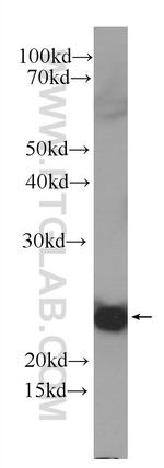 IL1F10 Antibody in Western Blot (WB)
