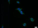 CD39/ENTPD1 Antibody in Immunocytochemistry (ICC/IF)