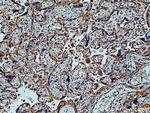 CD39/ENTPD1 Antibody in Immunohistochemistry (Paraffin) (IHC (P))