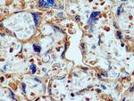 CD39/ENTPD1 Antibody in Immunohistochemistry (Paraffin) (IHC (P))