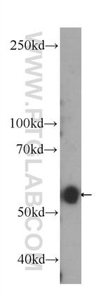 CD39/ENTPD1 Antibody in Western Blot (WB)