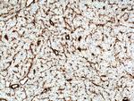 Vimentin Antibody in Immunohistochemistry (Paraffin) (IHC (P))