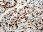 Vimentin Antibody in Immunohistochemistry (Paraffin) (IHC (P))
