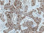 E-cadherin Antibody in Immunohistochemistry (Paraffin) (IHC (P))