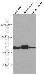 E-cadherin Antibody in Western Blot (WB)