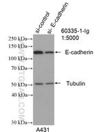 E-cadherin Antibody in Western Blot (WB)