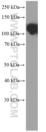 E-cadherin Antibody in Western Blot (WB)