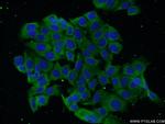 DBC1 Antibody in Immunocytochemistry (ICC/IF)