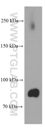DBC1 Antibody in Western Blot (WB)