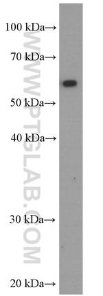 HEXA Antibody in Western Blot (WB)