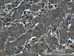 KLK3/PSA Antibody in Immunohistochemistry (Paraffin) (IHC (P))
