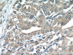 KLK3/PSA Antibody in Immunohistochemistry (Paraffin) (IHC (P))