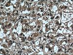 ADRP/Perilipin 2 Antibody in Immunohistochemistry (Paraffin) (IHC (P))