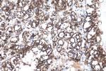 ADRP/Perilipin 2 Antibody in Immunohistochemistry (Paraffin) (IHC (P))