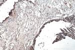 ADRP/Perilipin 2 Antibody in Immunohistochemistry (Paraffin) (IHC (P))