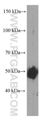 ADRP/Perilipin 2 Antibody in Western Blot (WB)