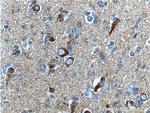 beta Amyloid Antibody in Immunohistochemistry (Paraffin) (IHC (P))