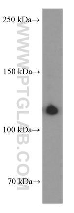 CD41/Integrin alpha 2b Antibody in Western Blot (WB)
