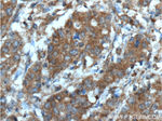 Inhibin beta A Antibody in Immunohistochemistry (Paraffin) (IHC (P))