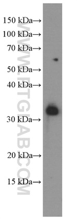 TIM3 Antibody in Western Blot (WB)