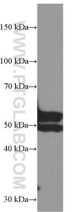 Myocilin Antibody in Western Blot (WB)