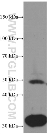 Myocilin Antibody in Western Blot (WB)