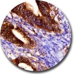 4E-BP1 Antibody in Immunohistochemistry (Paraffin) (IHC (P))