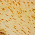 Amyloid beta Antibody in Immunohistochemistry (Paraffin) (IHC (P))
