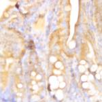 BAX Antibody in Immunohistochemistry (Paraffin) (IHC (P))