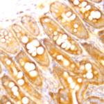 BAX Antibody in Immunohistochemistry (Paraffin) (IHC (P))