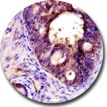 CD309/VEGFR2 Antibody in Immunohistochemistry (Paraffin) (IHC (P))