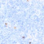 CD103 Antibody in Immunohistochemistry (Paraffin) (IHC (P))