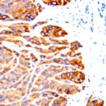 CD117 (c-kit) Antibody in Immunohistochemistry (Paraffin) (IHC (P))